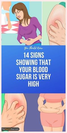 Signs Showing That Your Blood Sugar Is Very High